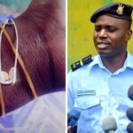 Icyo Polisi y’u Burundi ivuga ku bujura bw’ibitsina n’amabere y’abagore buvugwa muri iki gihugu